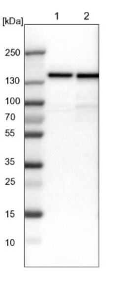 UBE4B Antibody, Novus Biologicals 25 &mu;L; Unlabeled:Antibodies, Polyclonal